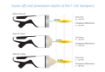 Poza cu INTELECT FOCAL SHOCKWAVE SET - CHATTANOOGA